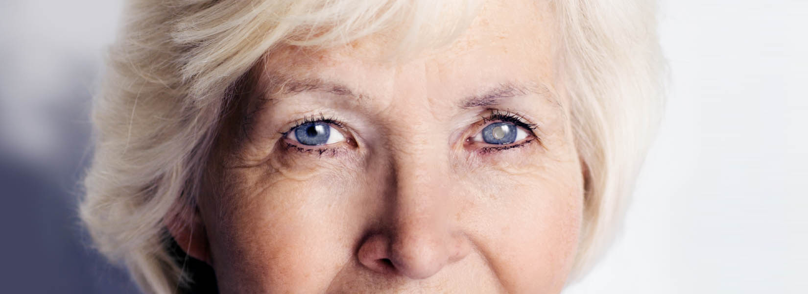 Cataract Surgery in Irwin